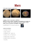 Voila quelques images de la planète mars